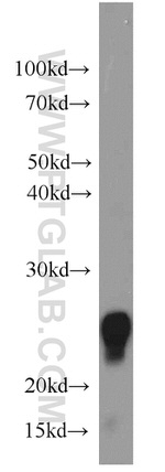 UBE2E3 Antibody in Western Blot (WB)