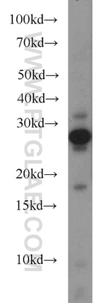 UBE2E3 Antibody in Western Blot (WB)