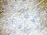 CPSF6 Antibody in Immunohistochemistry (Paraffin) (IHC (P))