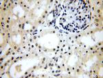 CPSF6 Antibody in Immunohistochemistry (Paraffin) (IHC (P))