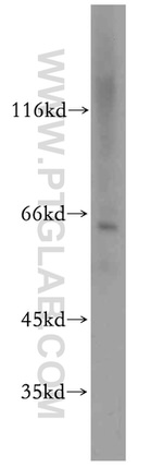 CPSF6 Antibody in Western Blot (WB)