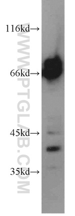 CPSF6 Antibody in Western Blot (WB)