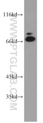 CPSF6 Antibody in Western Blot (WB)