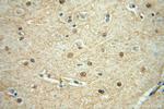 SCNM1 Antibody in Immunohistochemistry (Paraffin) (IHC (P))