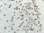 SCNM1 Antibody in Immunohistochemistry (Paraffin) (IHC (P))