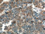 MARK2 Antibody in Immunohistochemistry (Paraffin) (IHC (P))