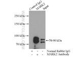 MARK2 Antibody in Immunoprecipitation (IP)