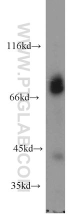 MARK2 Antibody in Western Blot (WB)