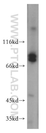 MARK2 Antibody in Western Blot (WB)