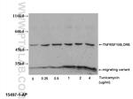 DR5 Antibody in Western Blot (WB)