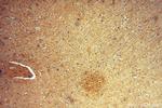 DISC1-long Antibody in Immunohistochemistry (Paraffin) (IHC (P))