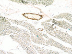 transgelin/SM22 Antibody in Immunohistochemistry (Paraffin) (IHC (P))