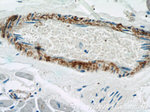 transgelin/SM22 Antibody in Immunohistochemistry (Paraffin) (IHC (P))