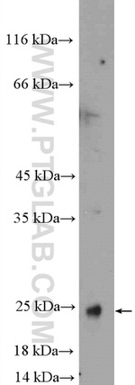 transgelin/SM22 Antibody in Western Blot (WB)