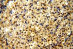 NFKB2 p52/p100 Antibody in Immunohistochemistry (Paraffin) (IHC (P))