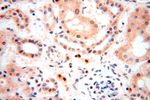 NFKB2 p52/p100 Antibody in Immunohistochemistry (Paraffin) (IHC (P))