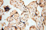 NFKB2 p52/p100 Antibody in Immunohistochemistry (Paraffin) (IHC (P))