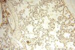 NFKB2 p52/p100 Antibody in Immunohistochemistry (Paraffin) (IHC (P))