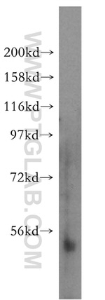 NFKB2 p52/p100 Antibody in Western Blot (WB)