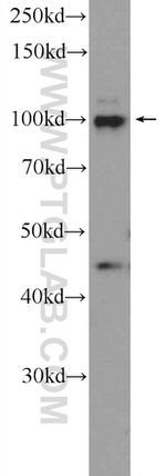 NFKB2 p52/p100 Antibody in Western Blot (WB)