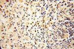 NFKB2 p52/p100 Antibody in Immunohistochemistry (Paraffin) (IHC (P))