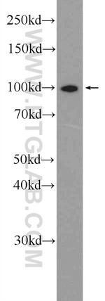 NFKB2 p52/p100 Antibody in Western Blot (WB)