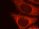 KISS1R Antibody in Immunocytochemistry (ICC/IF)