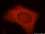 KISS1R Antibody in Immunocytochemistry (ICC/IF)