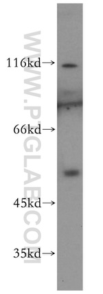 NFKB1 p105/p50 Antibody in Western Blot (WB)