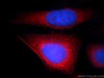 Transgelin-2 Antibody in Immunocytochemistry (ICC/IF)