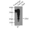 Transgelin-2 Antibody in Immunoprecipitation (IP)