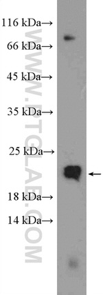 Transgelin-2 Antibody in Western Blot (WB)