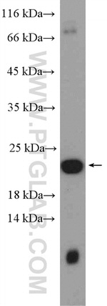 Transgelin-2 Antibody in Western Blot (WB)