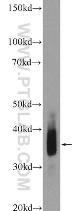 Cardiac Troponin T Antibody in Western Blot (WB)