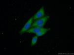 Beta galactosidase Antibody in Immunocytochemistry (ICC/IF)