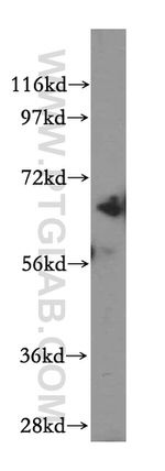 Beta galactosidase Antibody in Western Blot (WB)