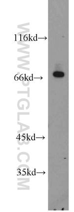 Beta galactosidase Antibody in Western Blot (WB)