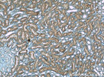 HACL1 Antibody in Immunohistochemistry (Paraffin) (IHC (P))