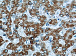 HACL1 Antibody in Immunohistochemistry (Paraffin) (IHC (P))