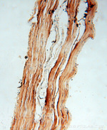 HACL1 Antibody in Immunohistochemistry (Paraffin) (IHC (P))