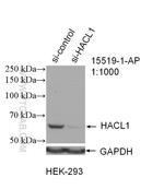 HACL1 Antibody in Western Blot (WB)