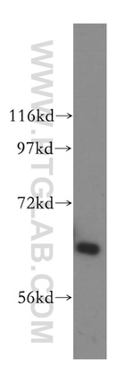 HACL1 Antibody in Western Blot (WB)