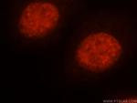 MSH2 Antibody in Immunocytochemistry (ICC/IF)