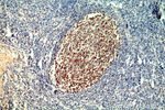 MSH2 Antibody in Immunohistochemistry (Paraffin) (IHC (P))