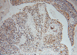 MSH2 Antibody in Immunohistochemistry (Paraffin) (IHC (P))