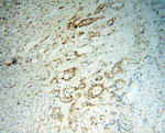 MSH2 Antibody in Immunohistochemistry (Paraffin) (IHC (P))