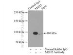 MSH2 Antibody in Immunoprecipitation (IP)