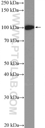 MSH2 Antibody in Western Blot (WB)