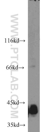 KCTD12 Antibody in Western Blot (WB)