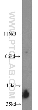 KCTD12 Antibody in Western Blot (WB)